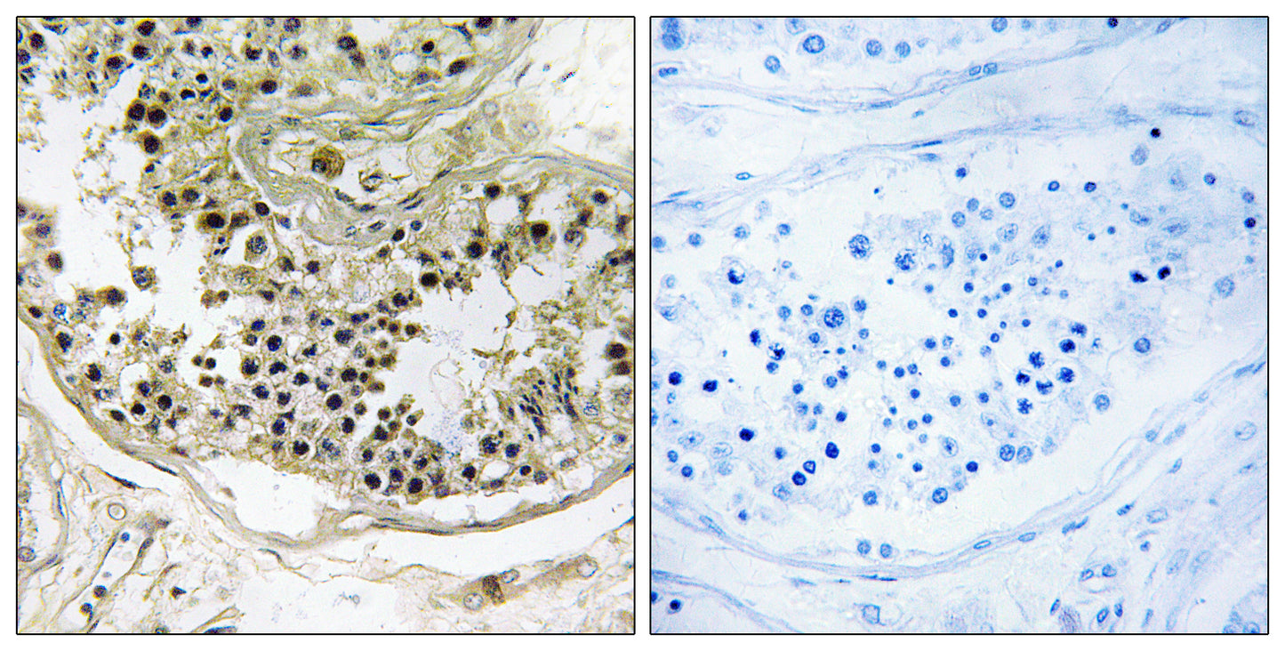 Dynein LC 2B Rabbit Polyclonal Antibody