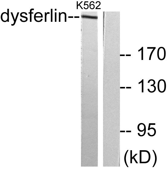 Dysferlin Rabbit Polyclonal Antibody