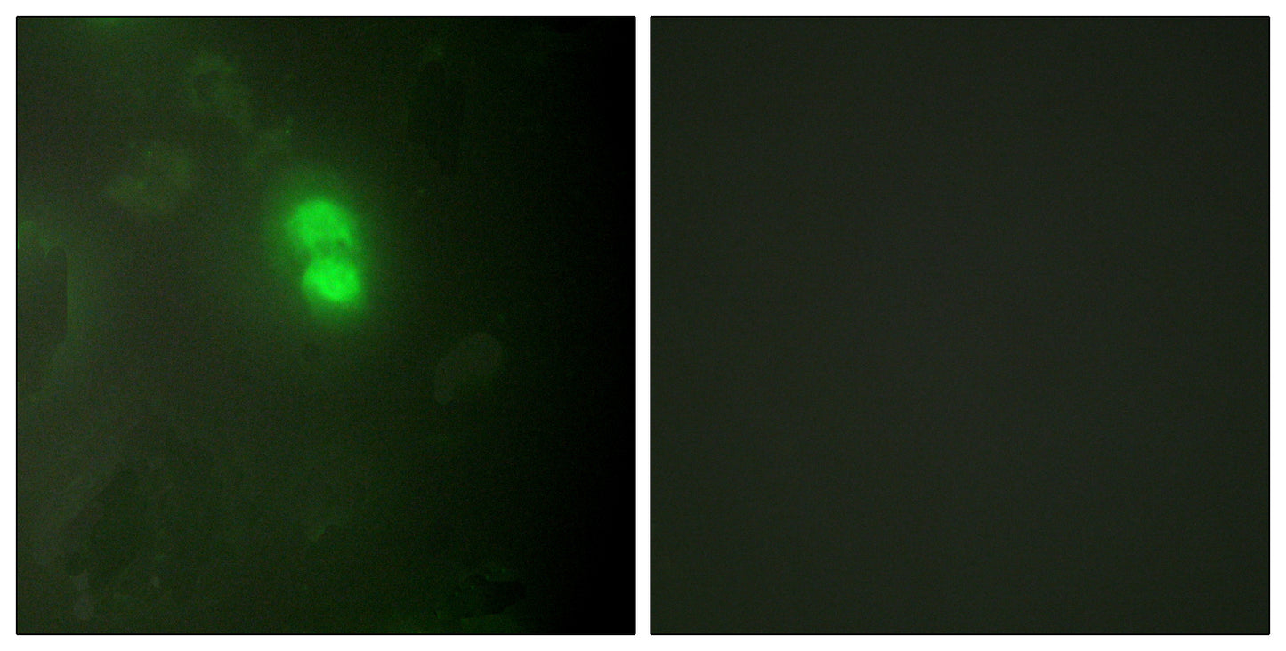 Dyskerin Rabbit Polyclonal Antibody