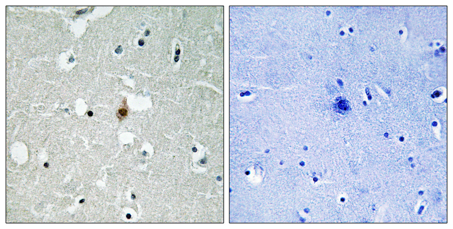 E2A Rabbit Polyclonal Antibody
