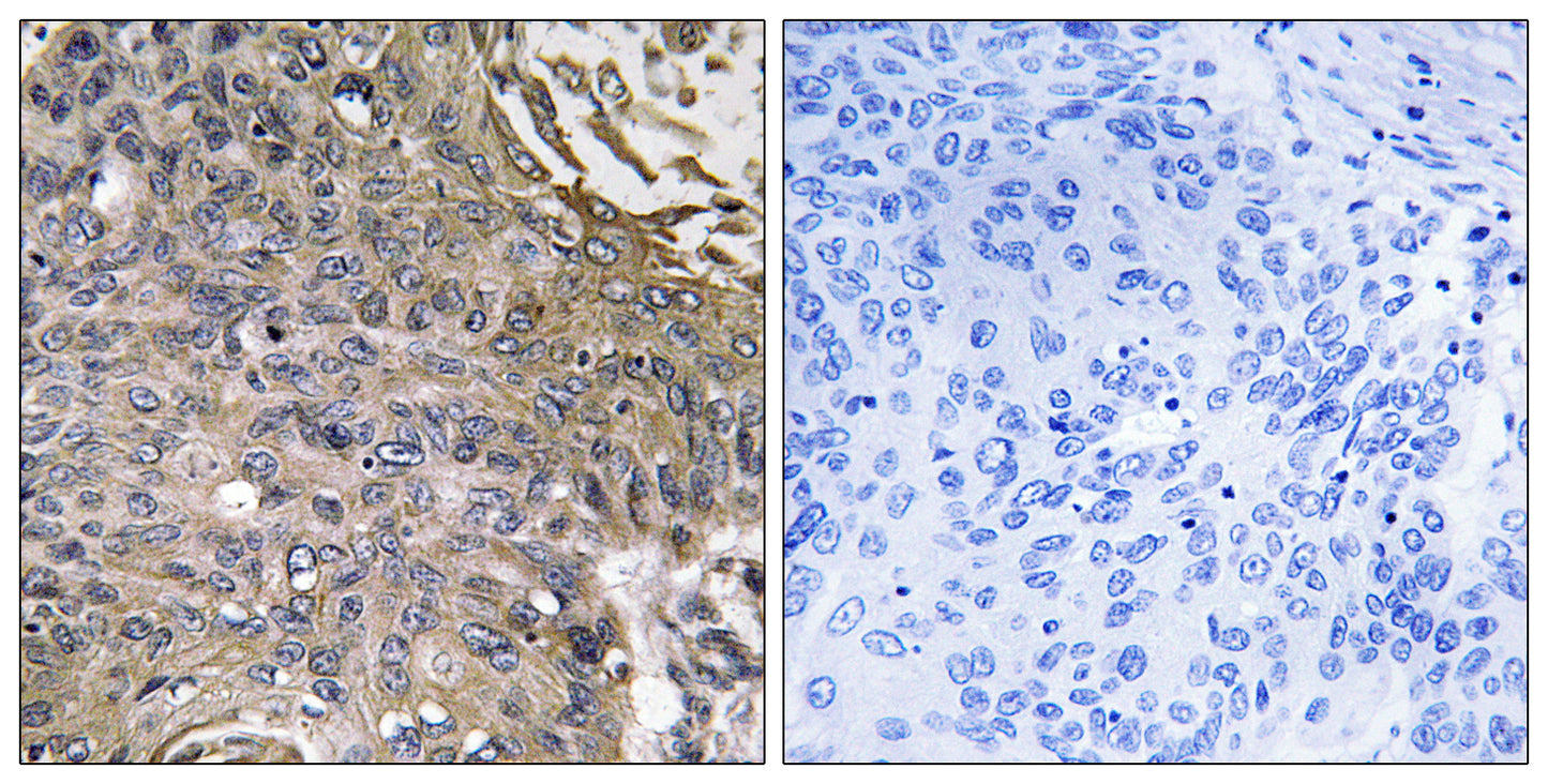 EAT-2 Rabbit Polyclonal Antibody