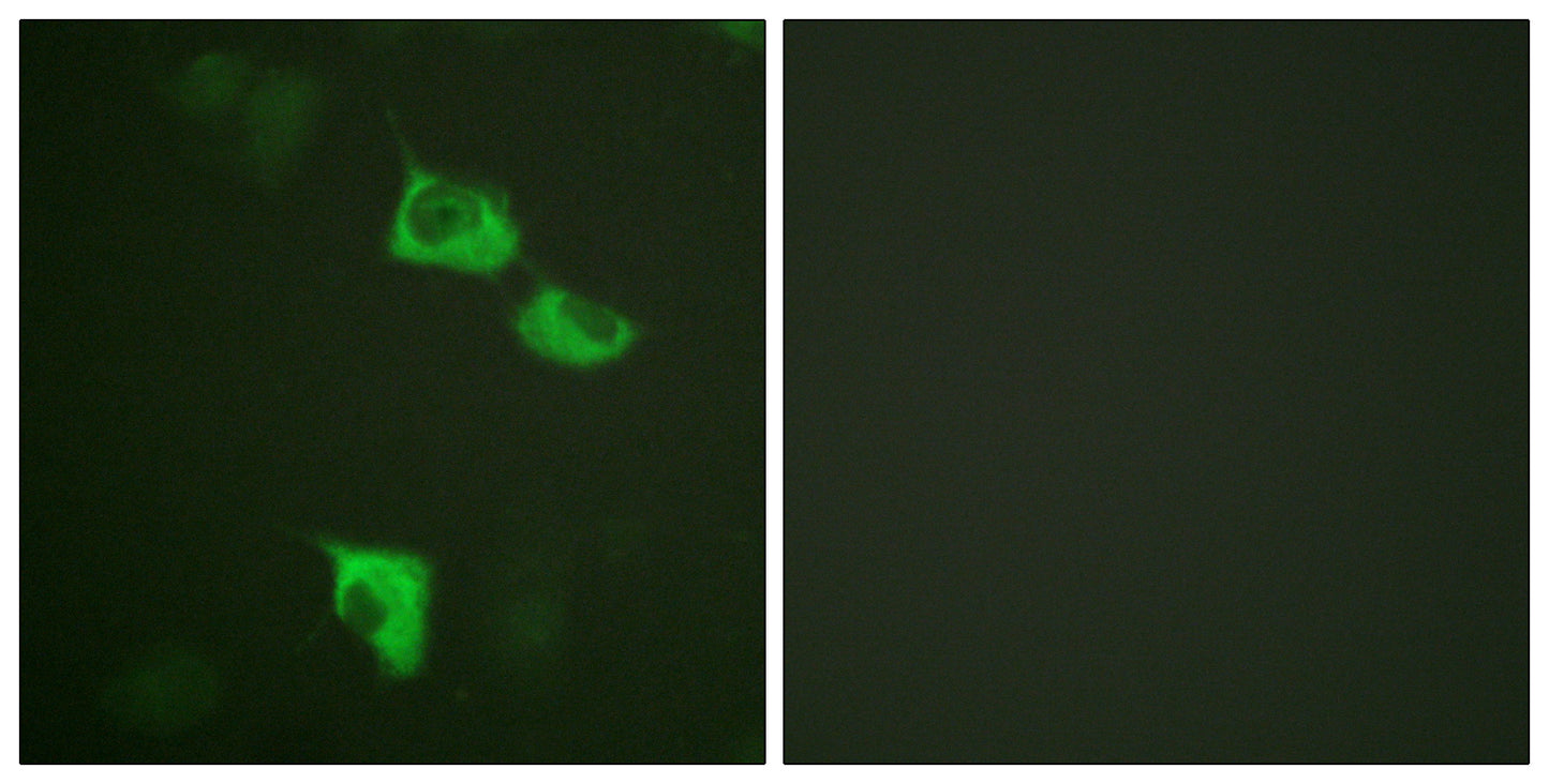 EF-2 Rabbit Polyclonal Antibody