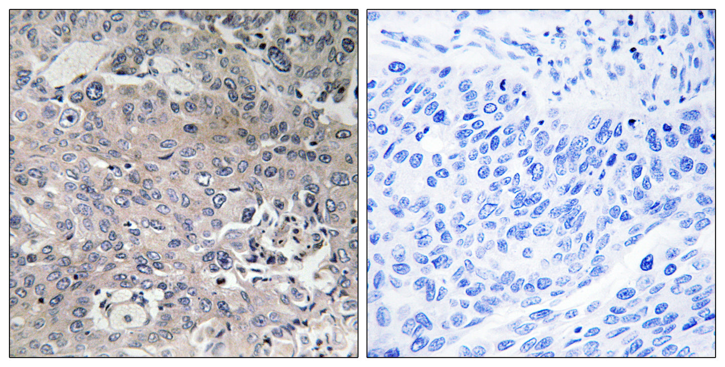 EF-Tu Rabbit Polyclonal Antibody