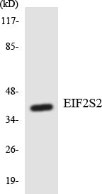 eIF2β Rabbit Polyclonal Antibody