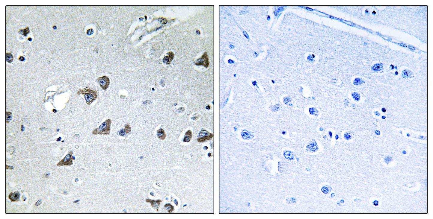 eIF3ε Rabbit Polyclonal Antibody