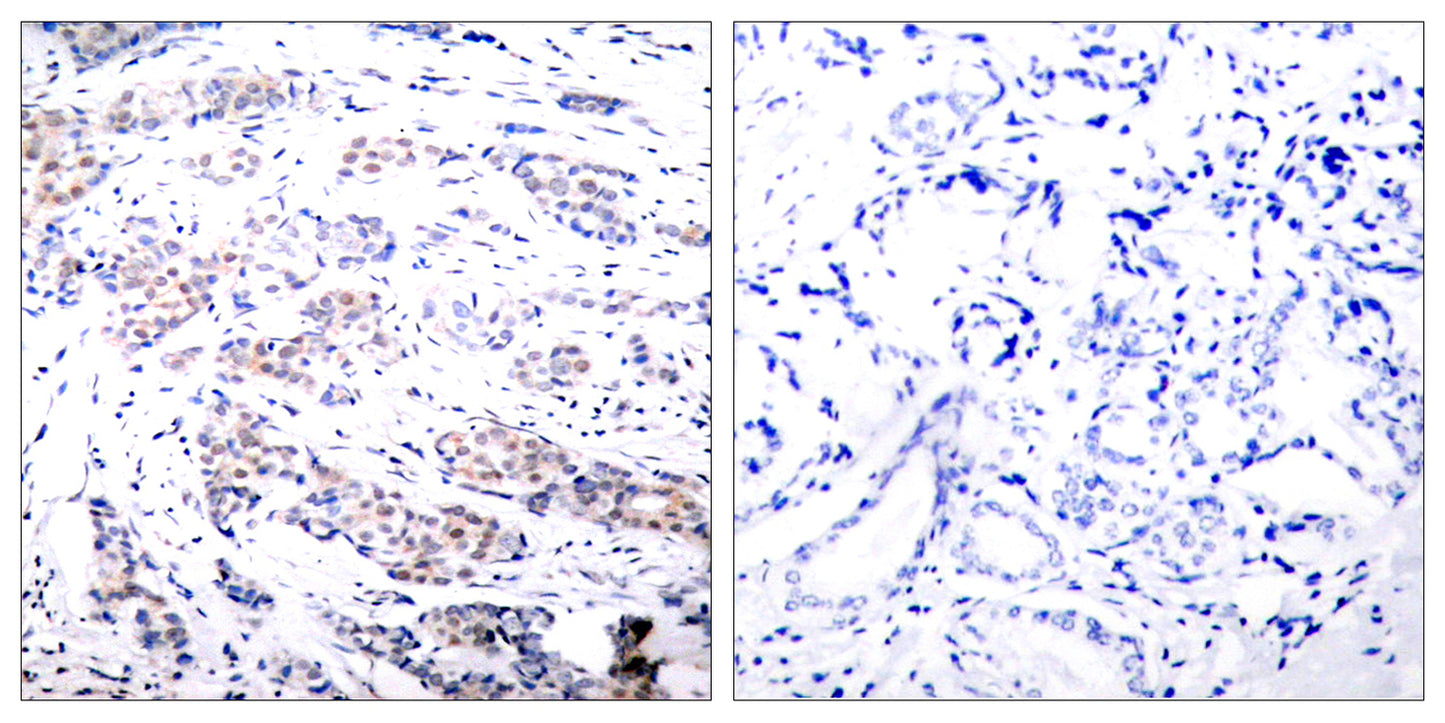 Elk-1 Rabbit Polyclonal Antibody