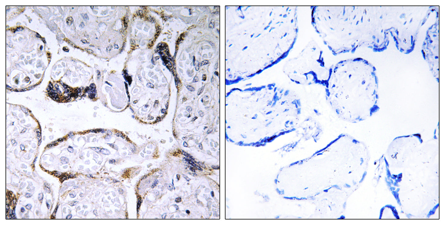 ELOVL3 Rabbit Polyclonal Antibody