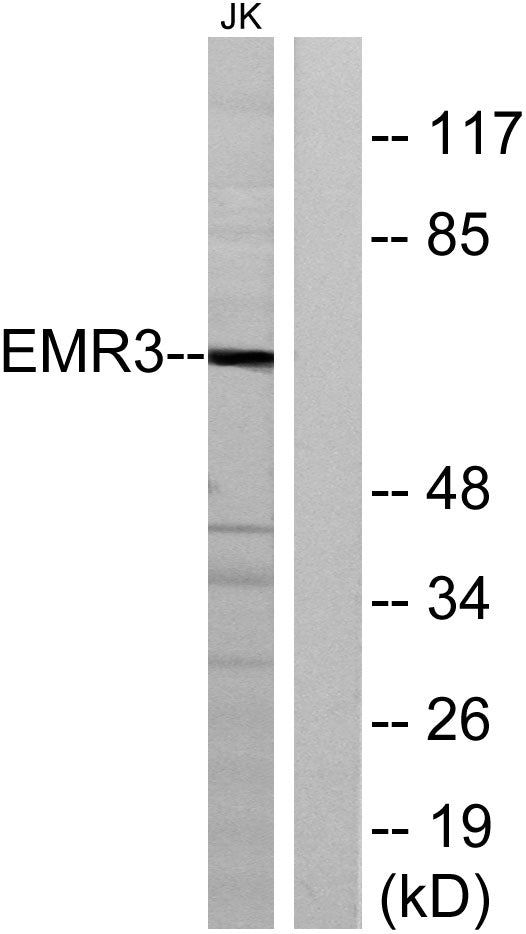EMR3 Rabbit Polyclonal Antibody