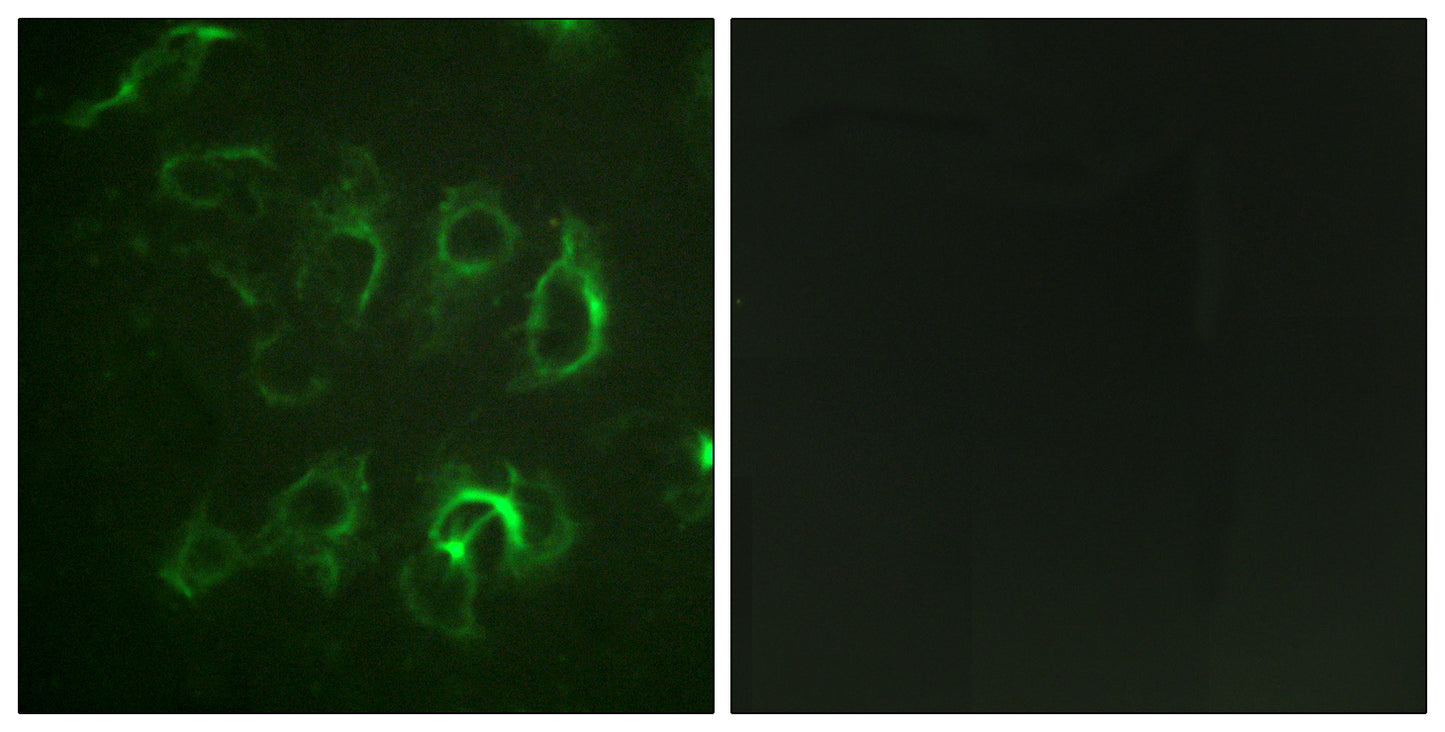 ENaC β Rabbit Polyclonal Antibody