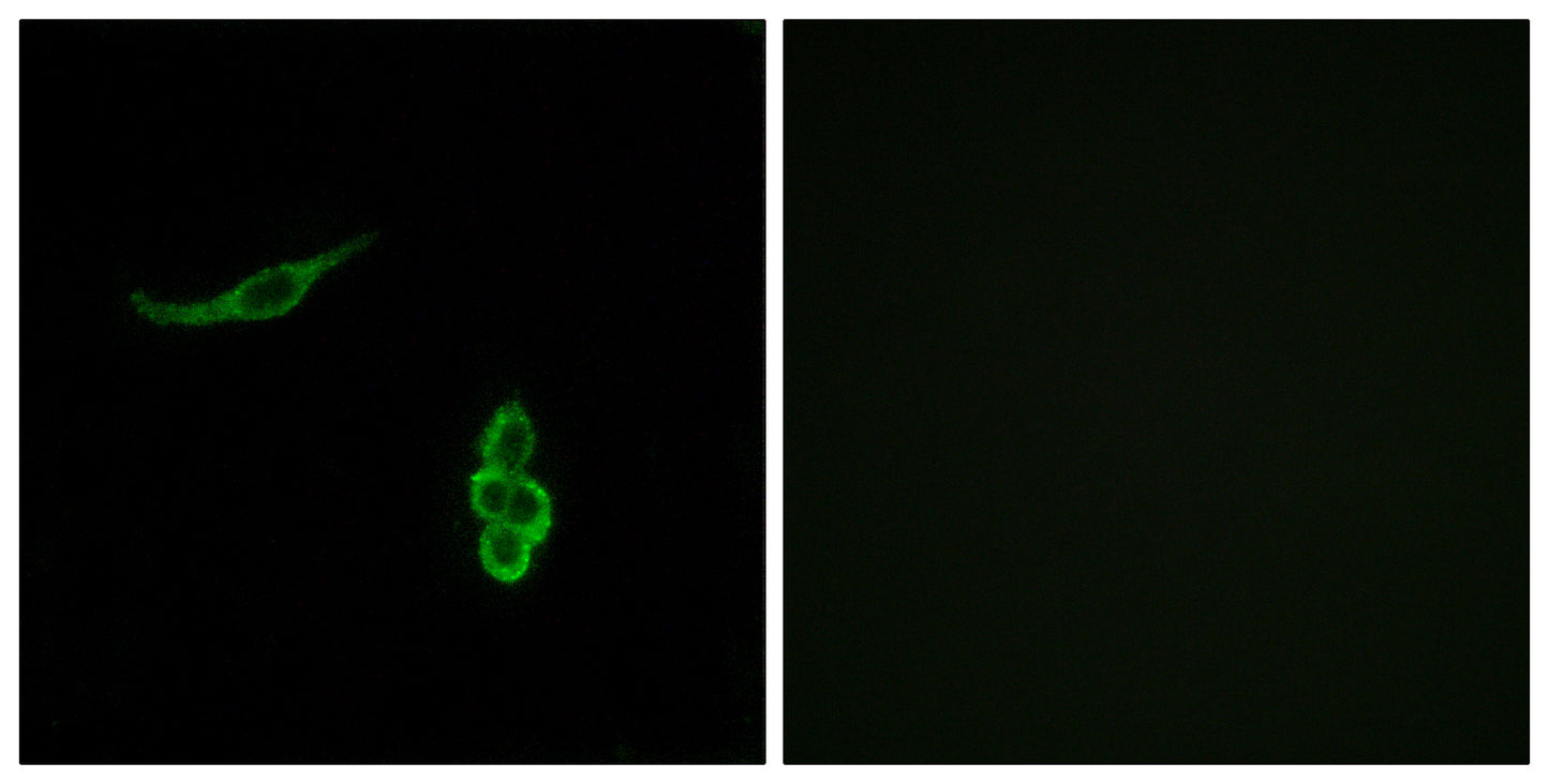ENaCδ Rabbit Polyclonal Antibody