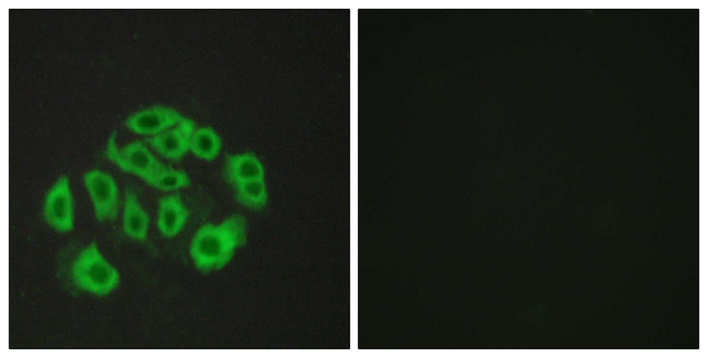 Endomucin Rabbit Polyclonal Antibody