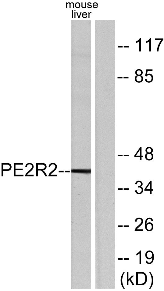 EP2 Rabbit Polyclonal Antibody