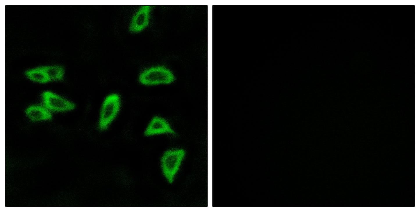 EP3 Rabbit Polyclonal Antibody