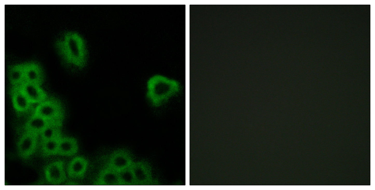EP4 Rabbit Polyclonal Antibody