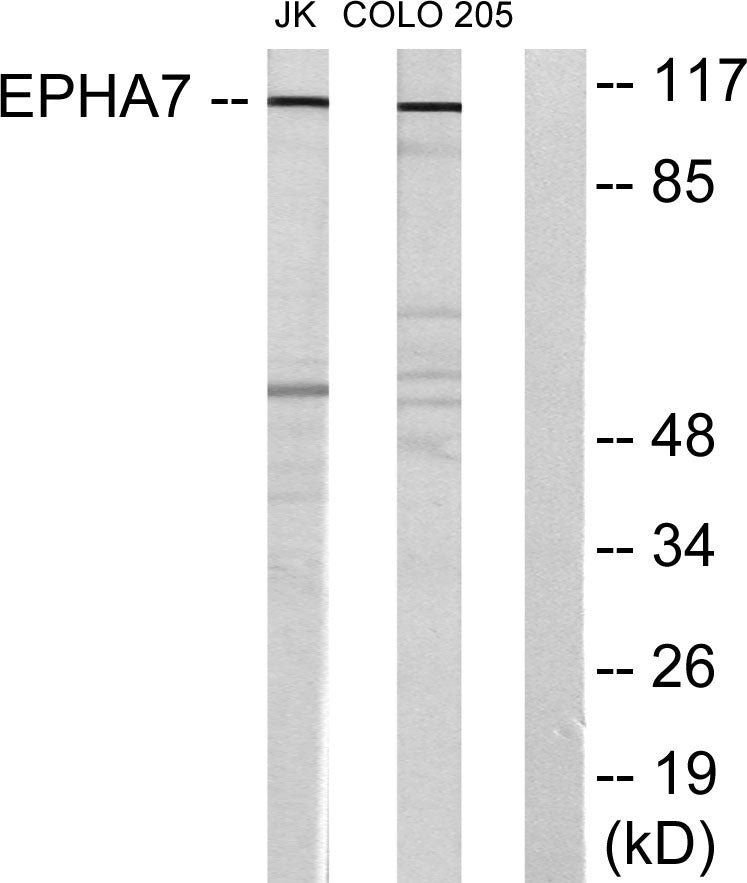 EphA7 Rabbit Polyclonal Antibody