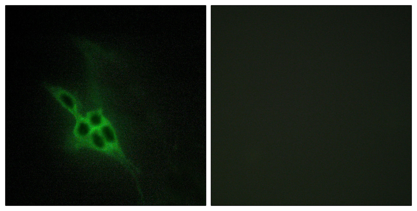EphB1/2/3 Rabbit Polyclonal Antibody