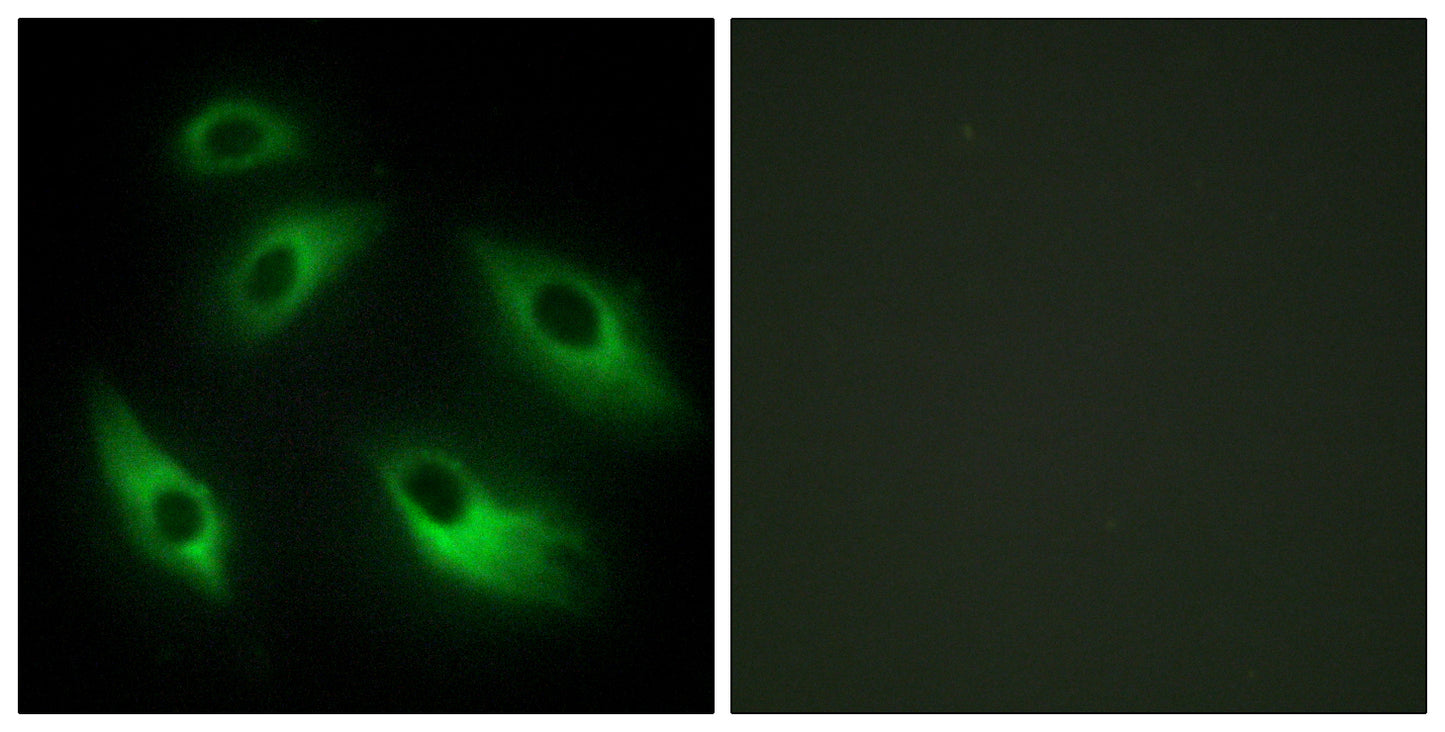 EphB6 Rabbit Polyclonal Antibody