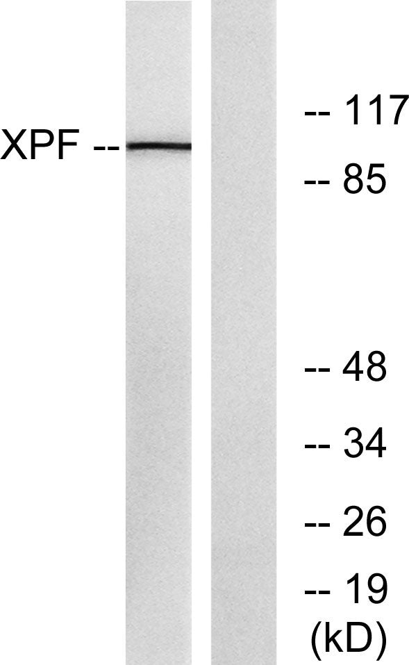 ERCC4 Rabbit Polyclonal Antibody