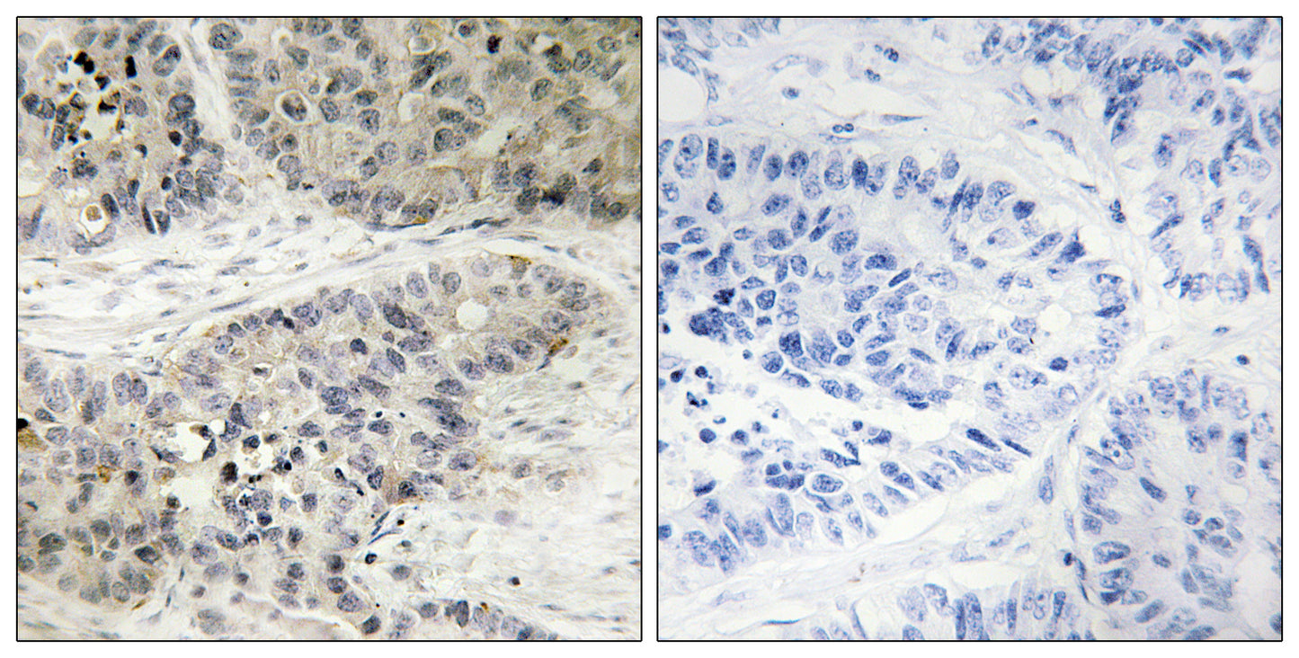 ERK 8 Rabbit Polyclonal Antibody