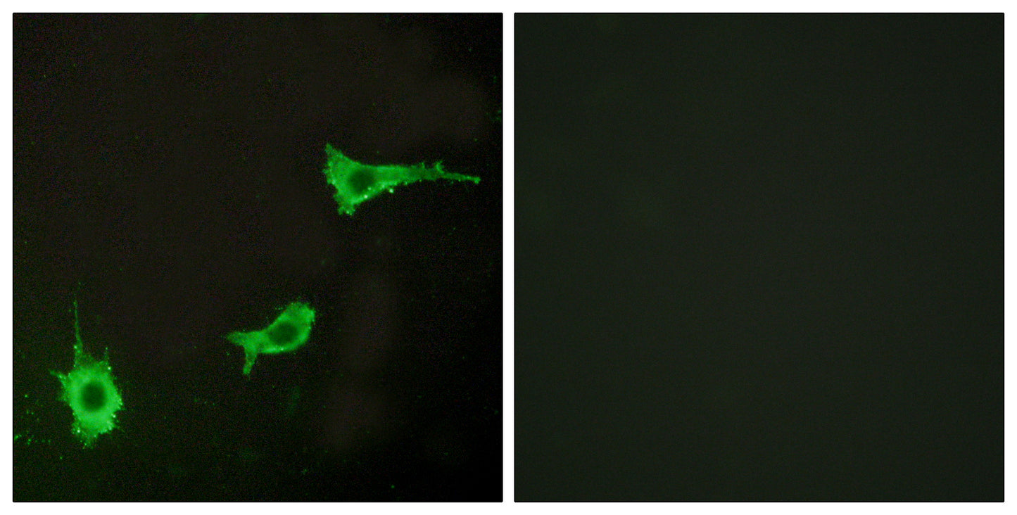 ETAR Rabbit Polyclonal Antibody