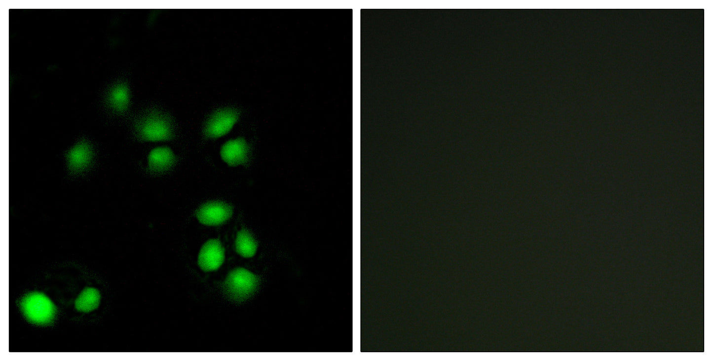 Exo1 Rabbit Polyclonal Antibody