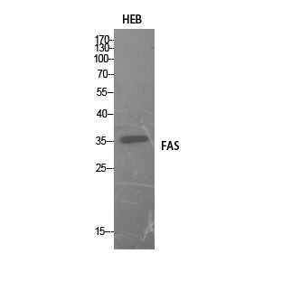 FAS Rabbit Polyclonal Antibody
