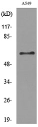 Fascin 1 Rabbit Polyclonal Antibody
