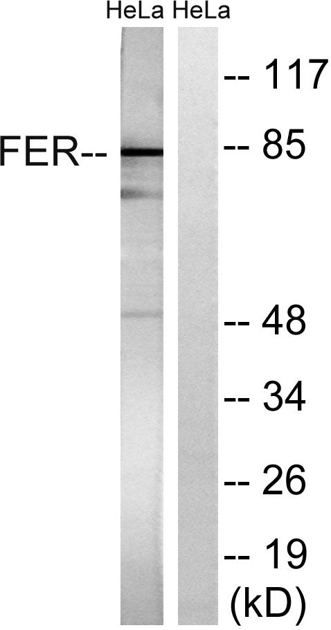 Fer Rabbit Polyclonal Antibody