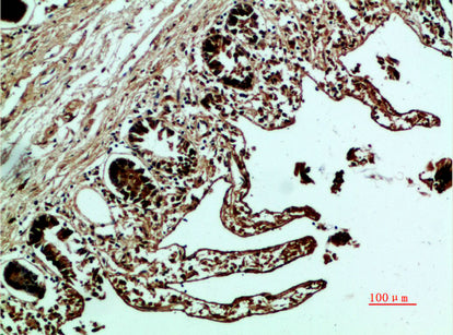 Fibronectin Rabbit Polyclonal Antibody