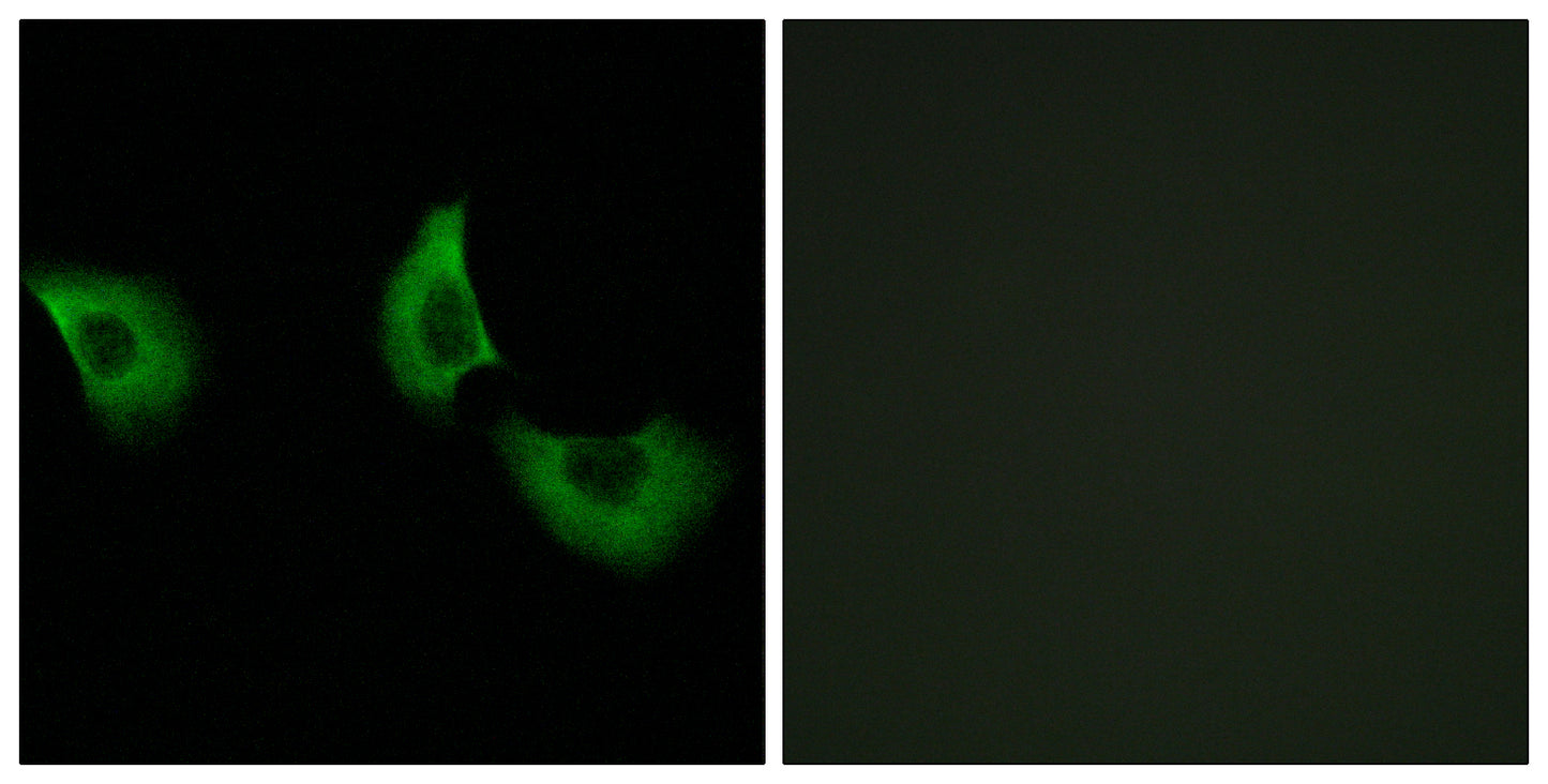 Fibulin-4 Rabbit Polyclonal Antibody