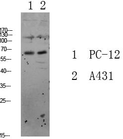 FKHRL1 Rabbit Polyclonal Antibody