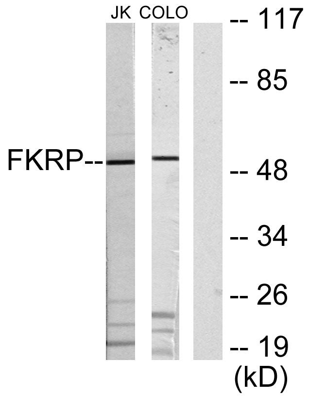 FKRP Rabbit Polyclonal Antibody