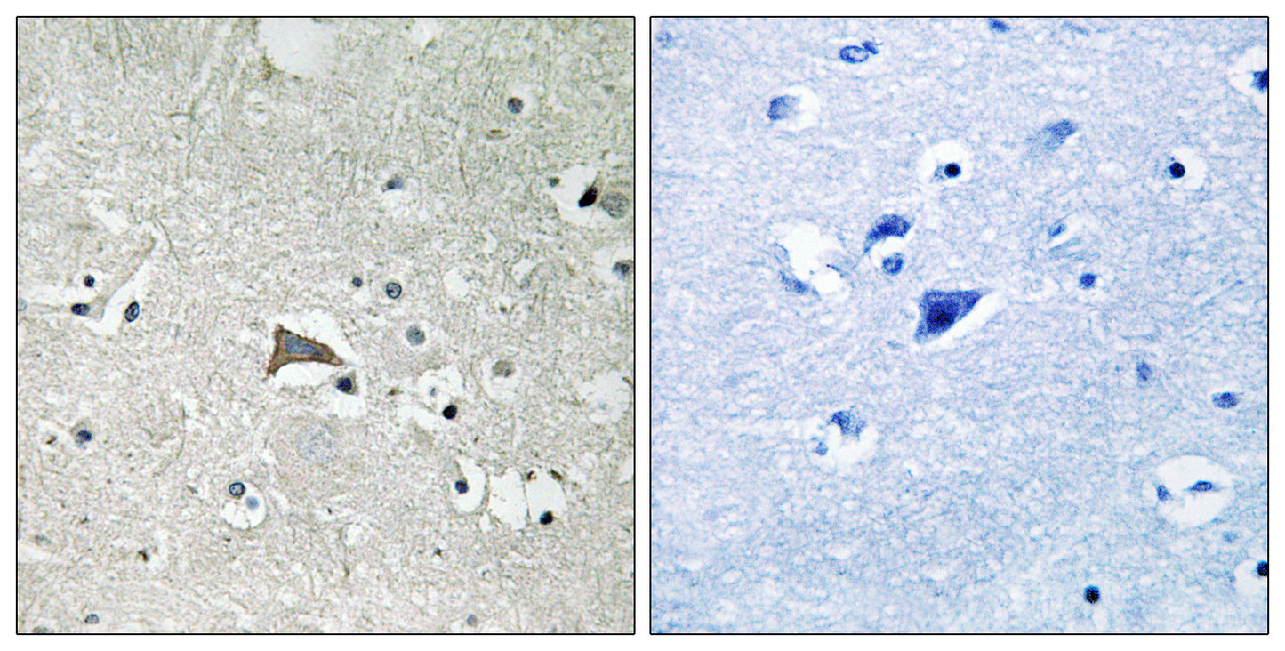 Flt-1 Rabbit Polyclonal Antibody