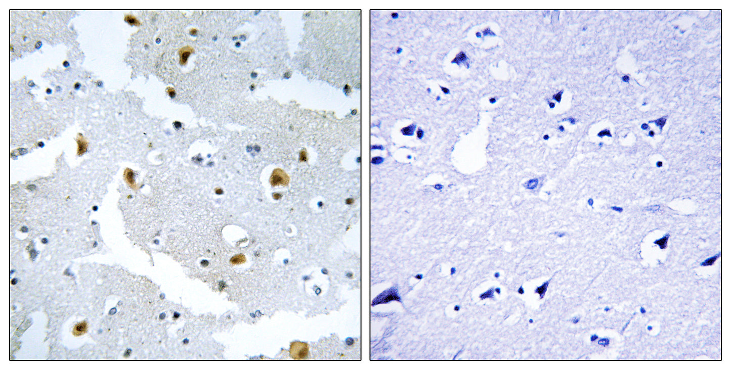 Formin 2 Rabbit Polyclonal Antibody