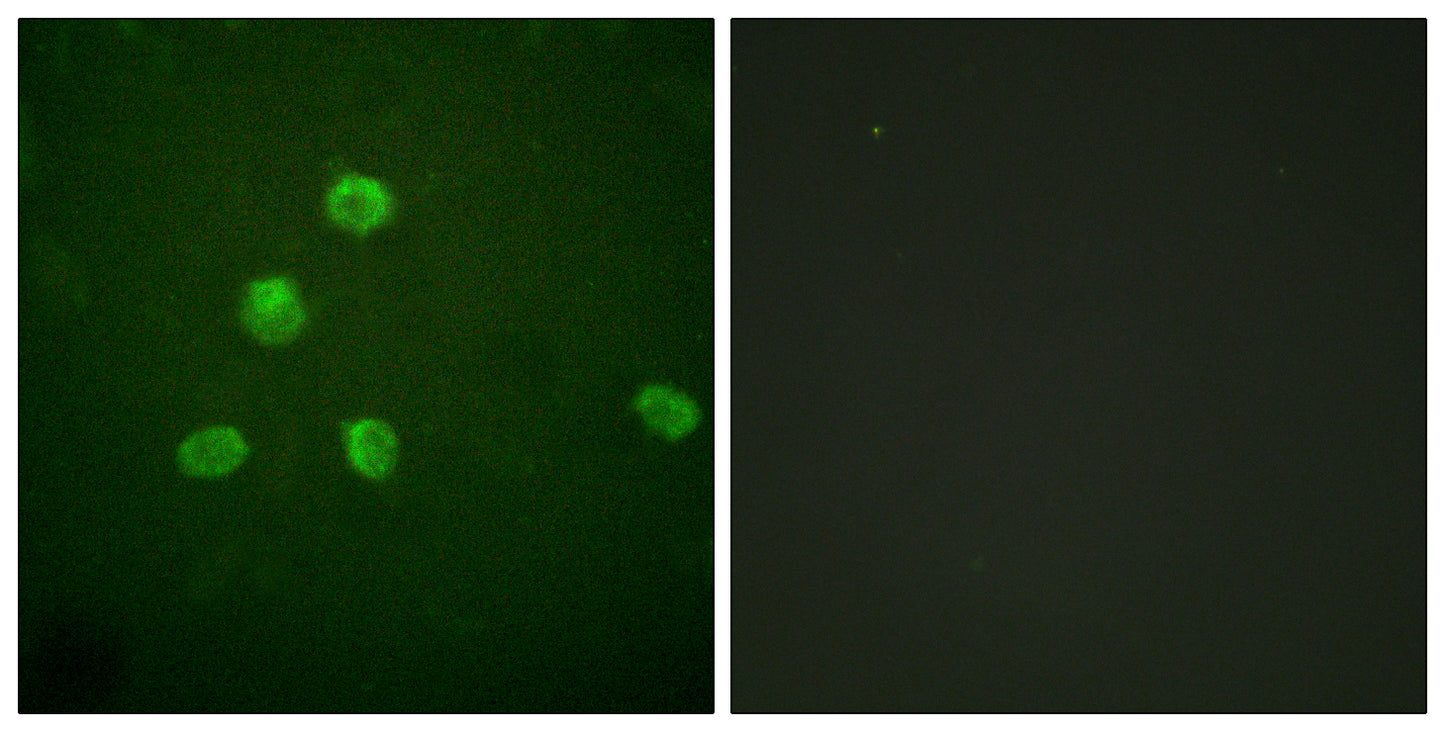 Fos B Rabbit Polyclonal Antibody
