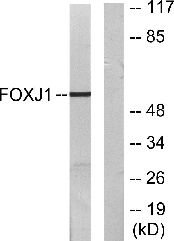 FoxJ1 Rabbit Polyclonal Antibody