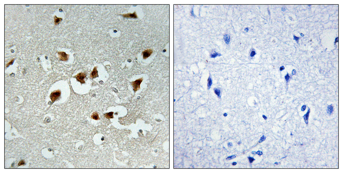 FoxO4 Rabbit Polyclonal Antibody