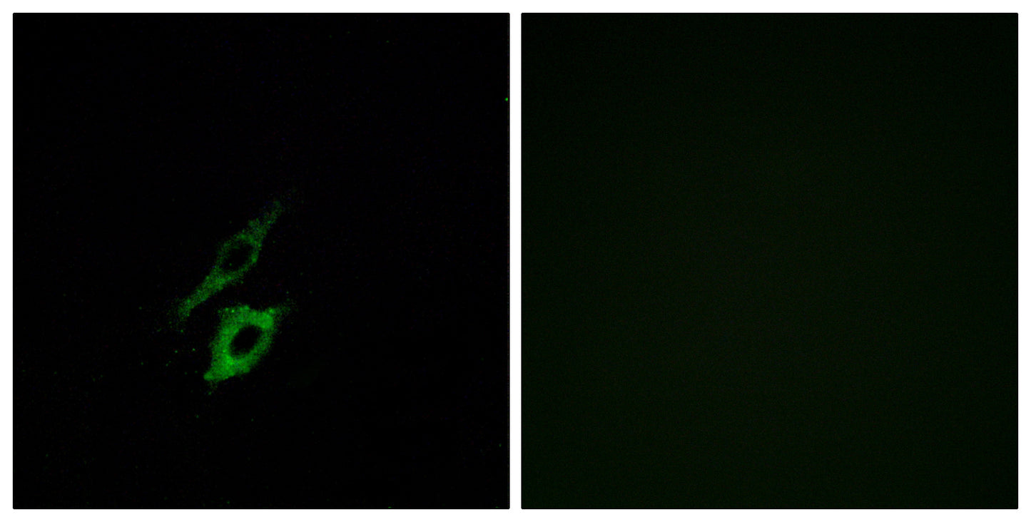FPR1 Rabbit Polyclonal Antibody