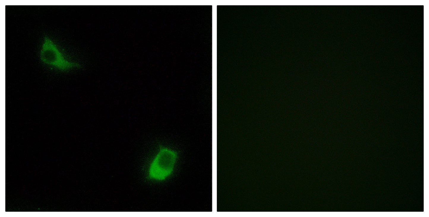 FPRL2 Rabbit Polyclonal Antibody