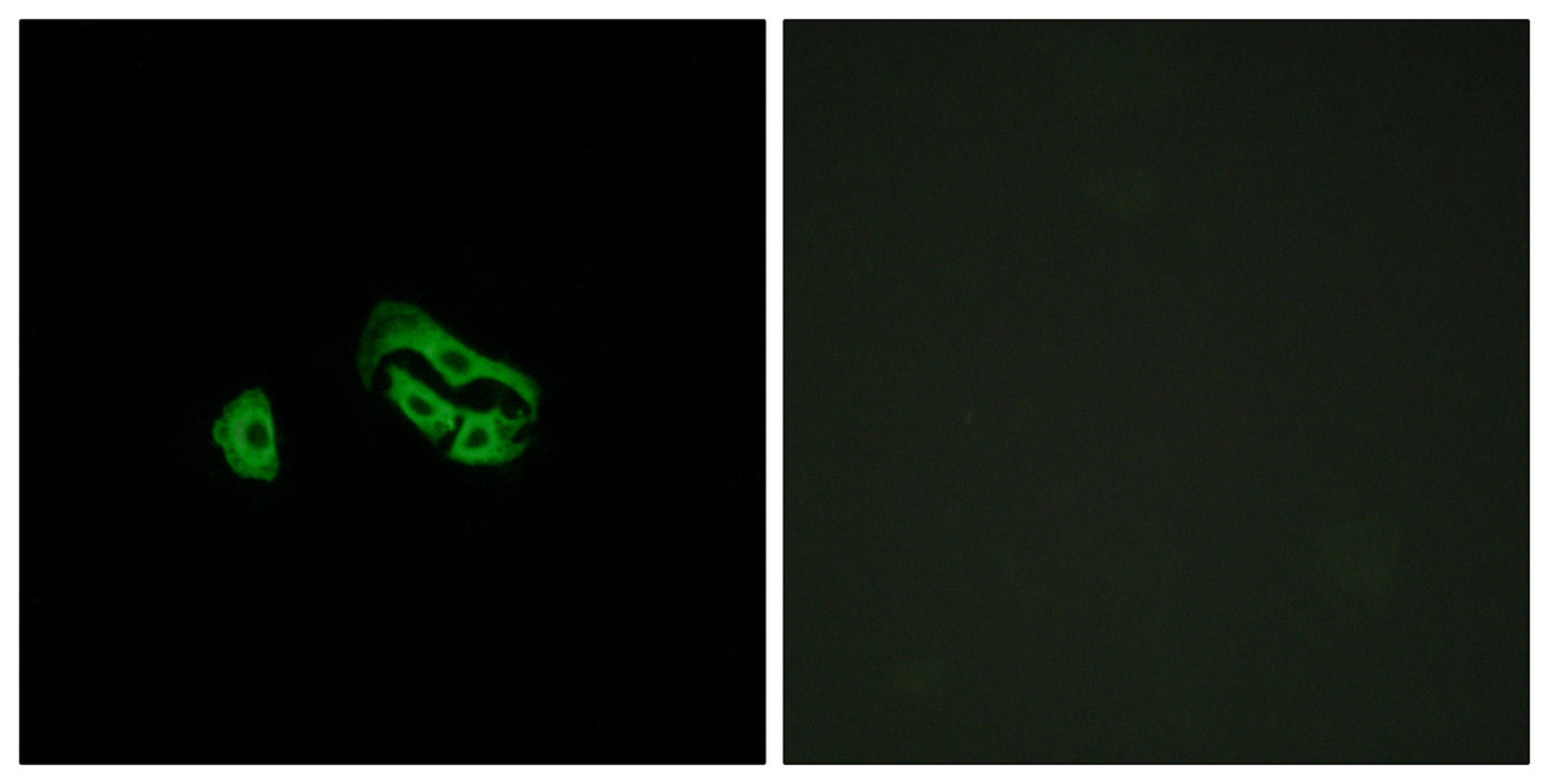 FPRL2 Rabbit Polyclonal Antibody