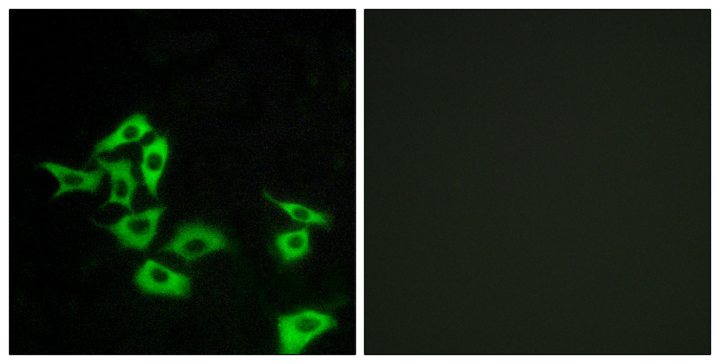 Frizzled-5/8 Rabbit Polyclonal Antibody