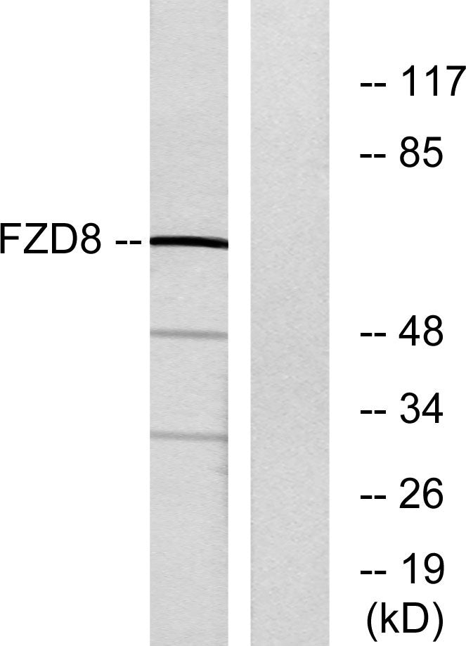 Frizzled-8 Rabbit Polyclonal Antibody
