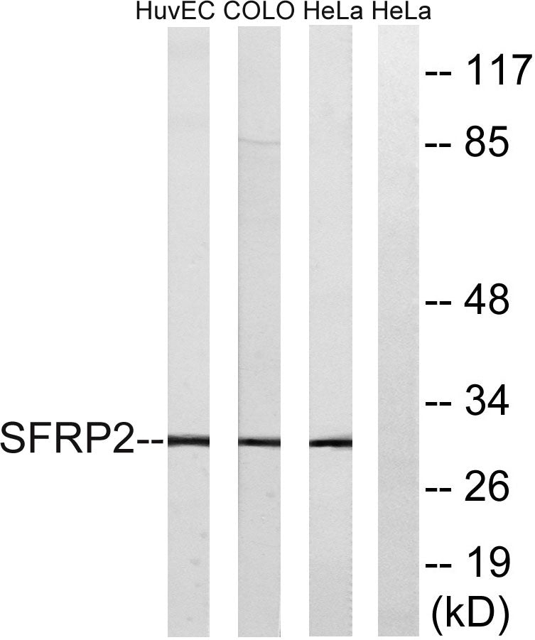 FRP-2 Rabbit Polyclonal Antibody