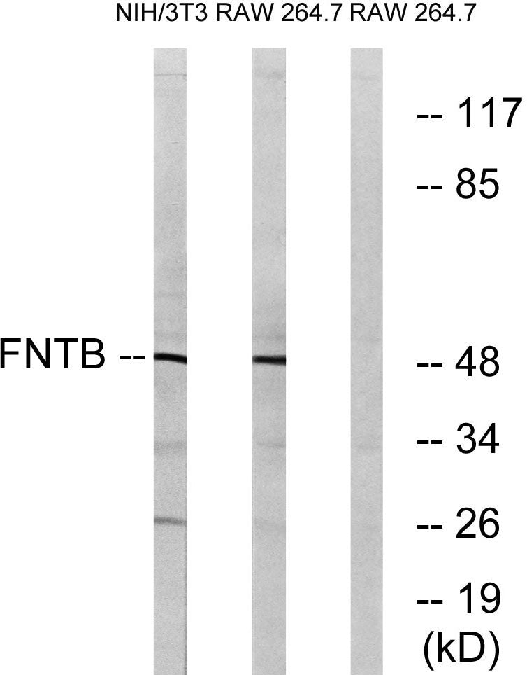FTβ Rabbit Polyclonal Antibody