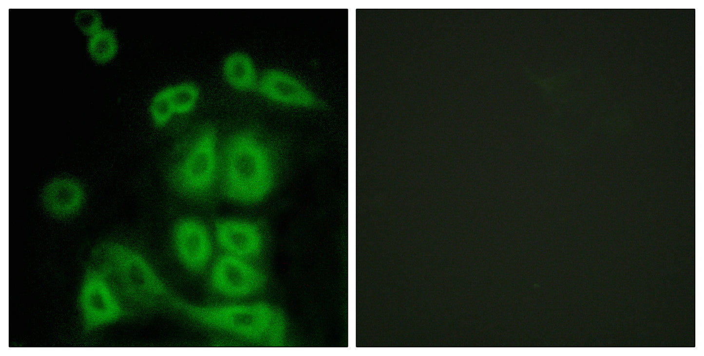 FXR2 Rabbit Polyclonal Antibody