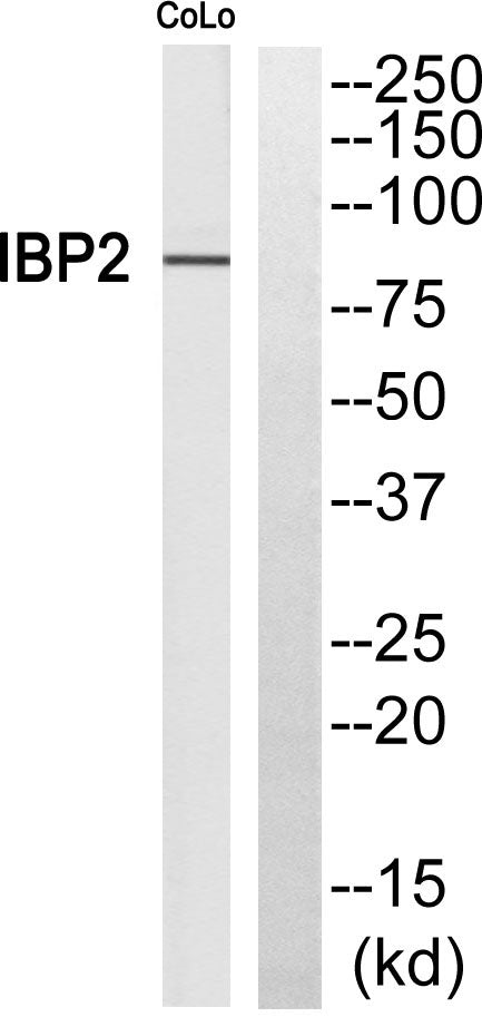 Fyb Rabbit Polyclonal Antibody