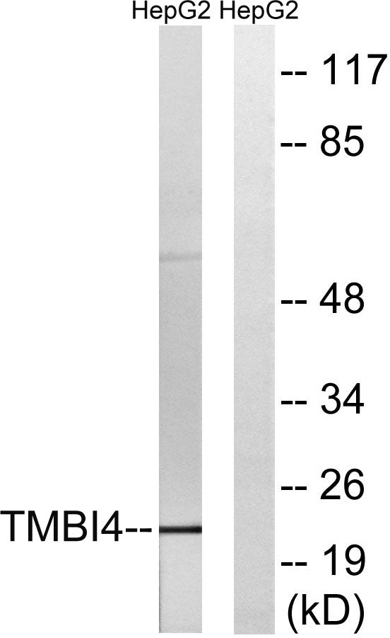 GAAP Rabbit Polyclonal Antibody