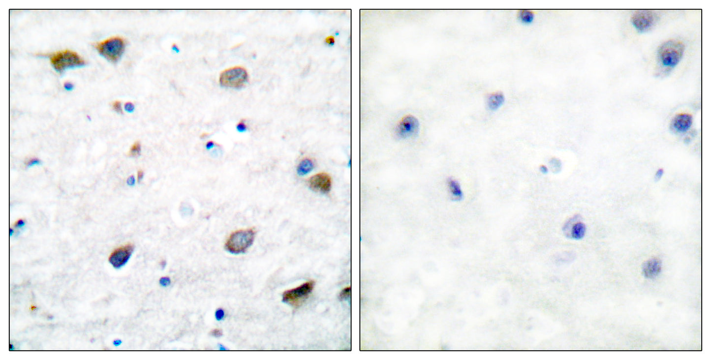 GABAA Rβ1 Rabbit Polyclonal Antibody