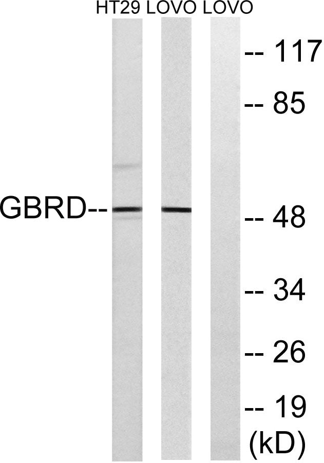 GABAA Rδ Rabbit Polyclonal Antibody