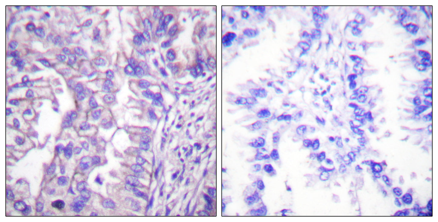 GAD-65/67 Rabbit Polyclonal Antibody